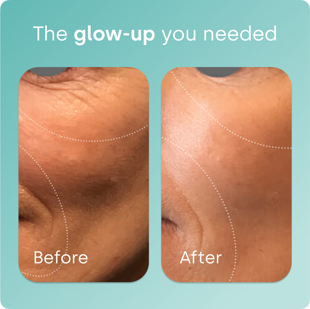 Collagen Generator - Drops