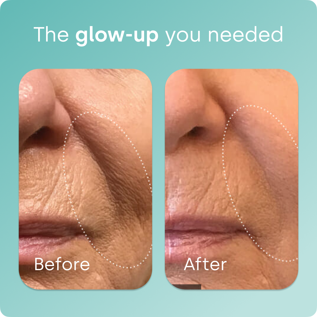Collagen Generator - Liquid Capsules