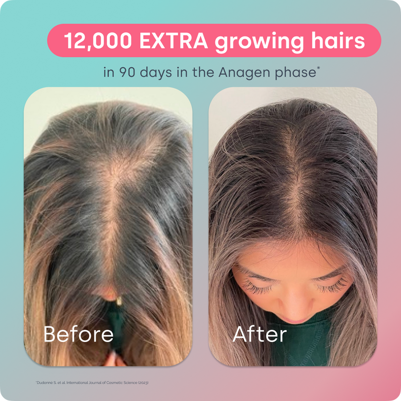 advanced-hair-growth-formula-biosil-store