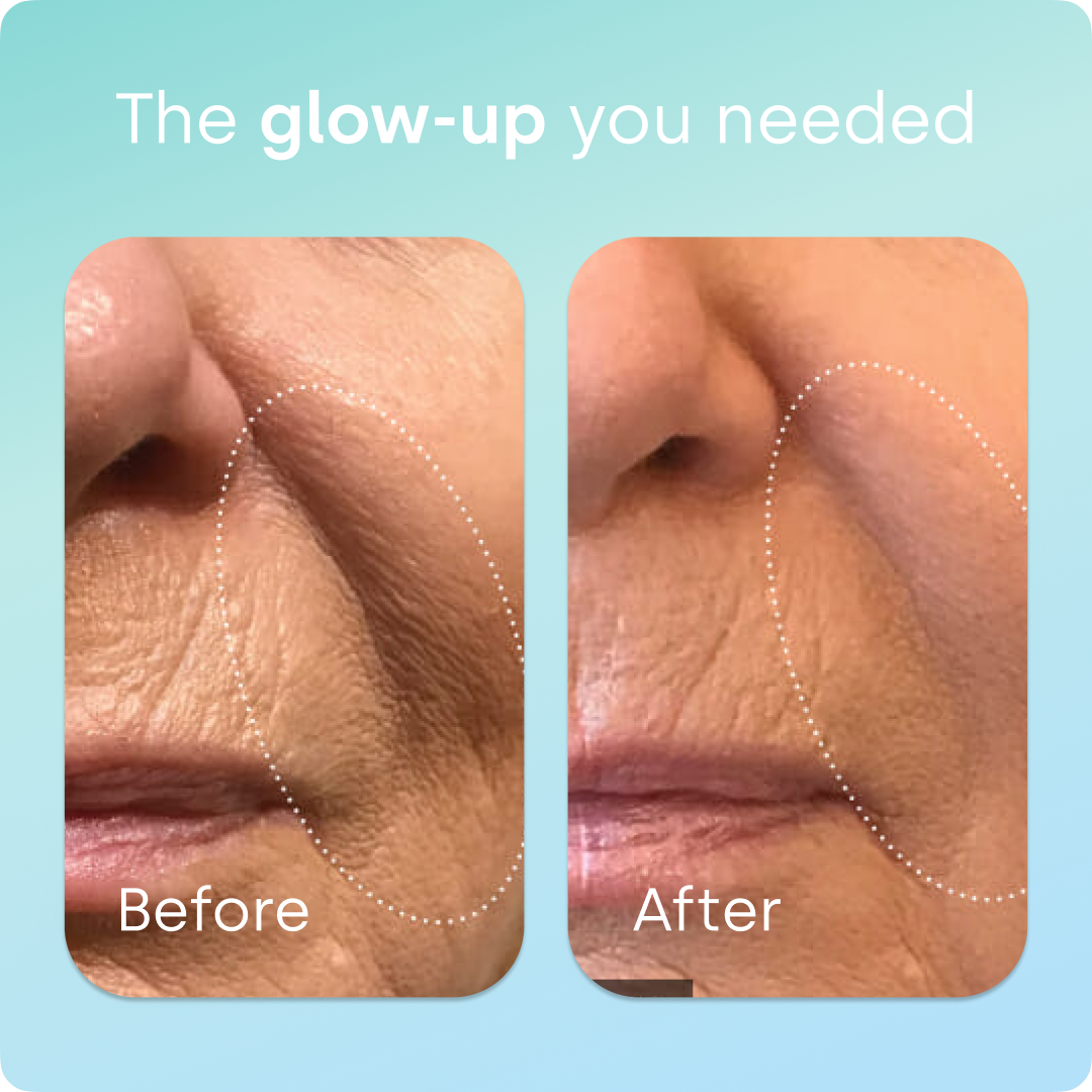 Healthy Aging