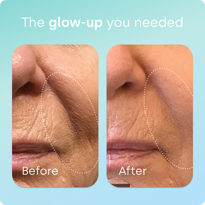 Healthy Aging