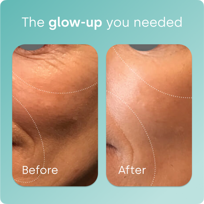 Collagen Generator - Drops