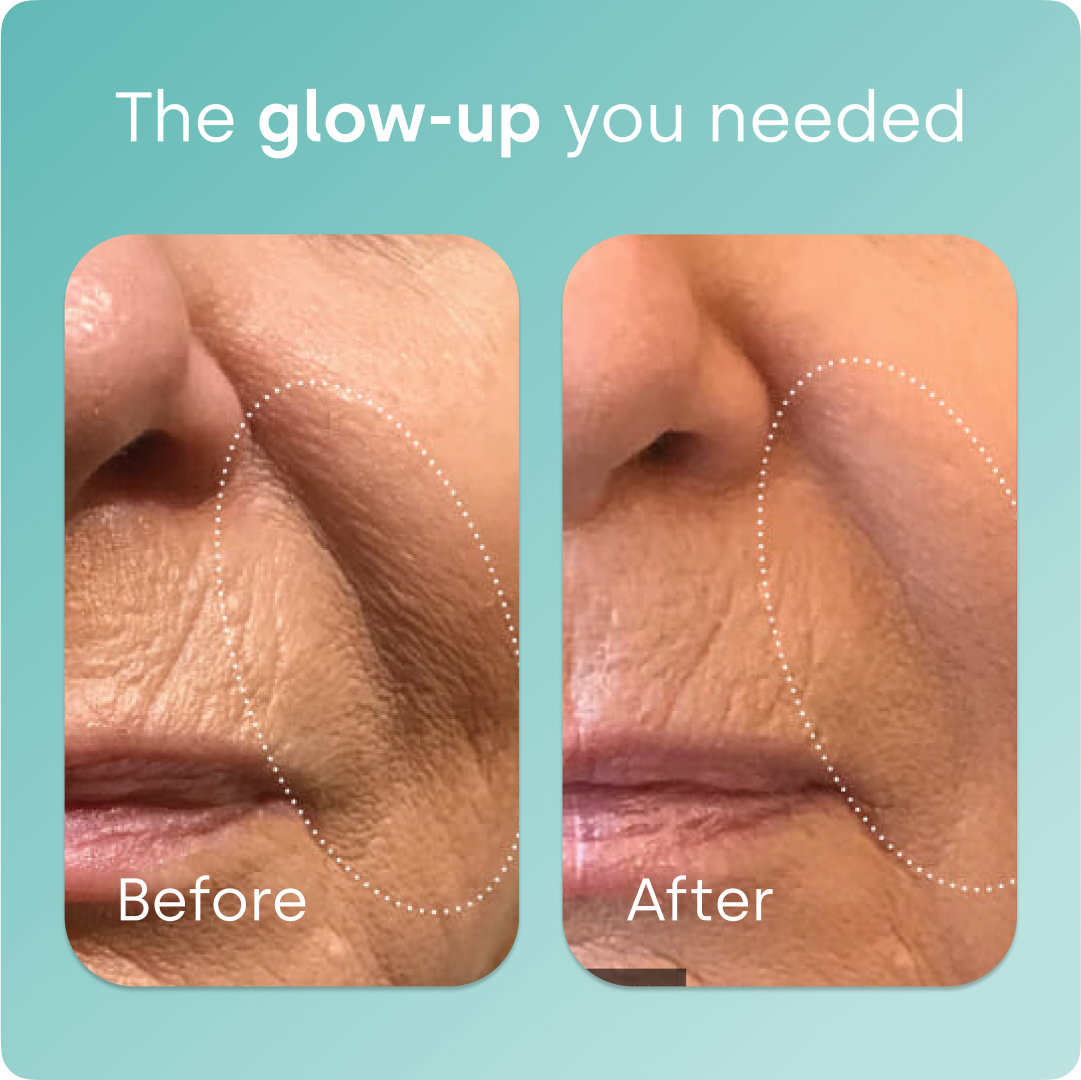 Collagen Generator - Drops
