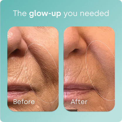 Collagen Generator - Drops