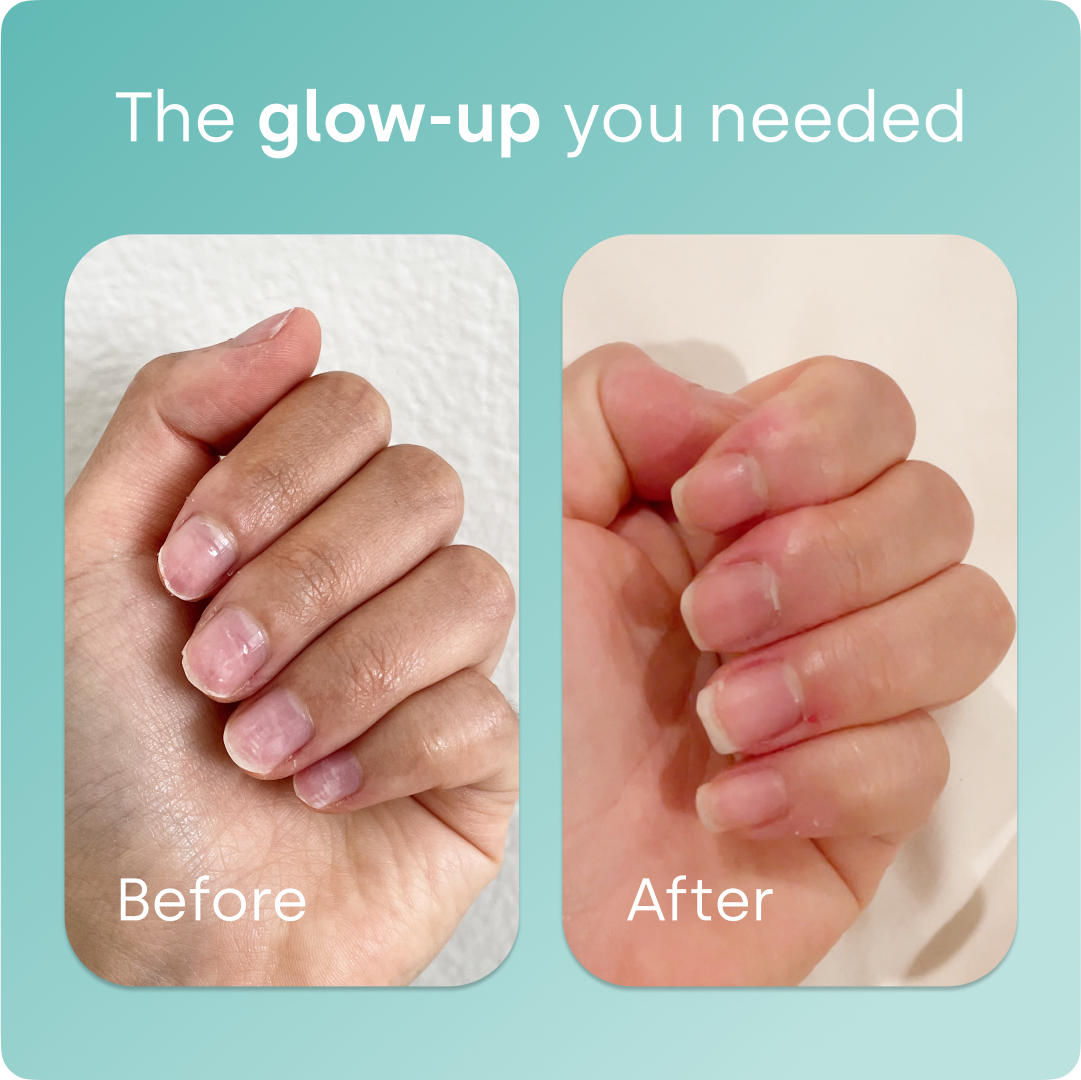 Collagen Generator - Original Capsules – Biosil Store