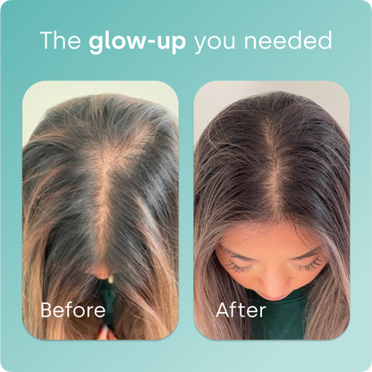 Collagen Generator - Original Capsules