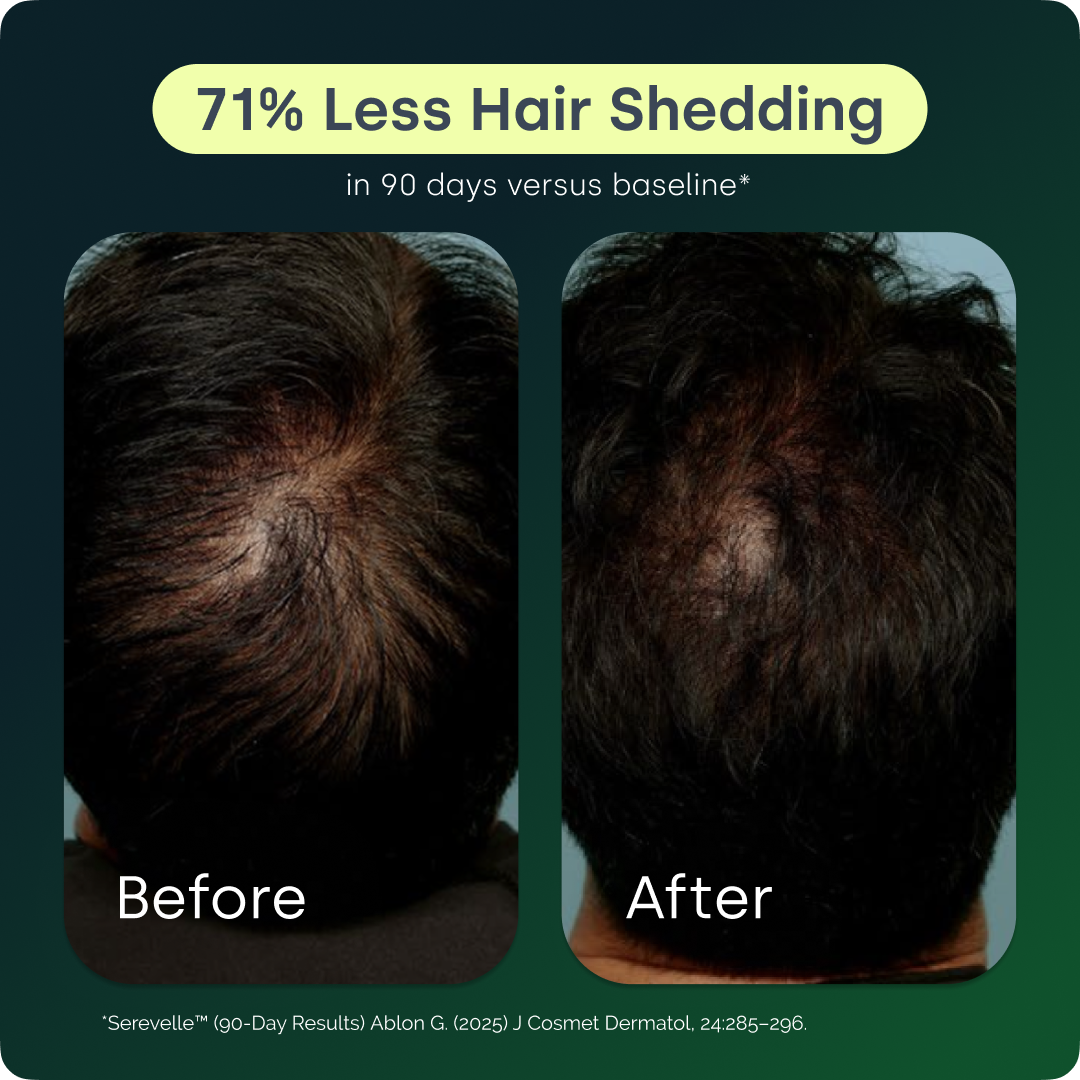 Biosil Men - Hair Growth Fuel