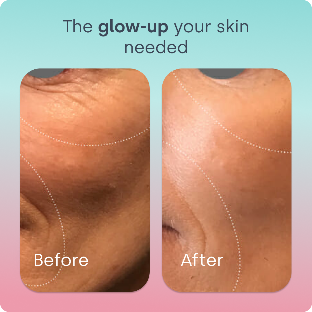 Skin Renew Elixir