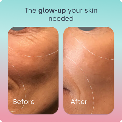 Skin Renew Elixir