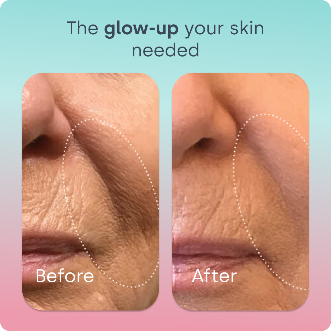 Skin Renew Elixir