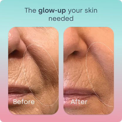 Skin Renew Elixir